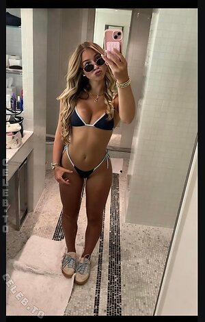 Abby Champlin Nude Leaked Photo #11