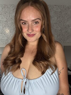 FreckledNat