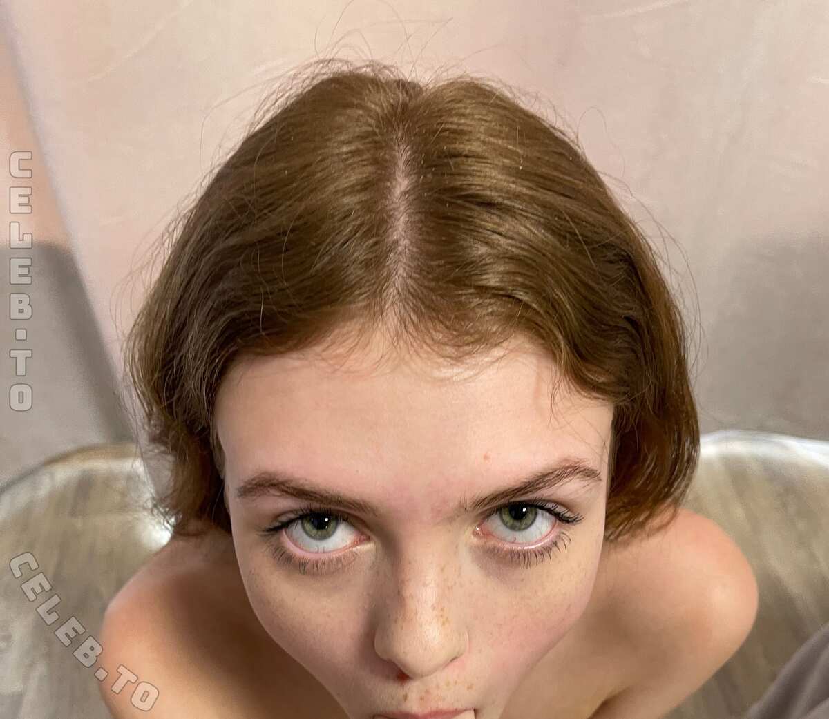 freckles photo