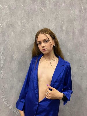 freckles leaked photo #734