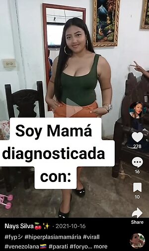 Gigantomastia Nude Leaked Photo #30