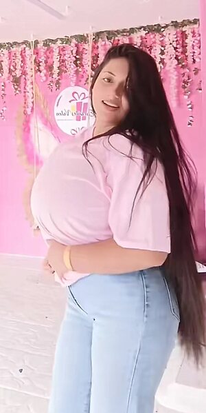 Gigantomastia