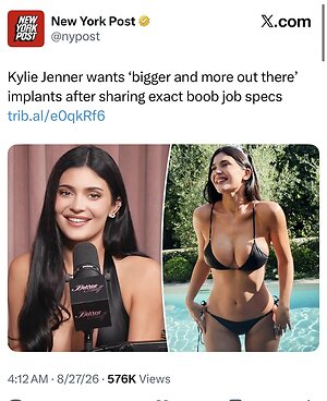 Huge Implants Nude Leaked Photo #6