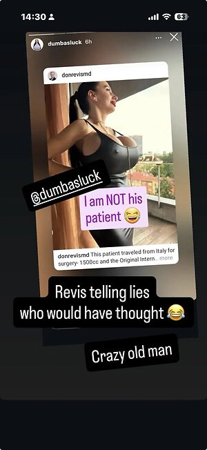 Huge Implants leaked photo #42