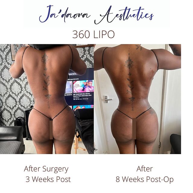 Ivorian Doll leaked photos