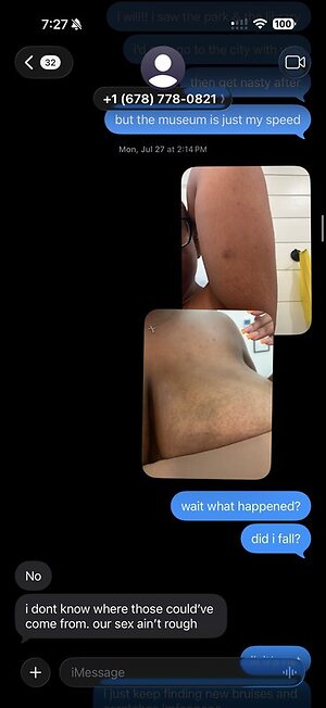 Kambbino Nude Leaked Photo #4