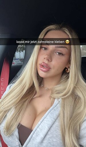 Milaneedls leaked photo #69