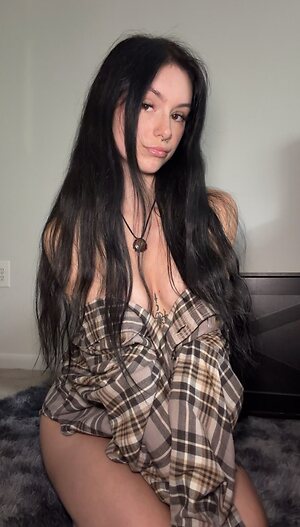Ropebite
