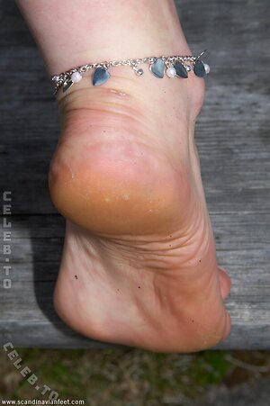 Scandinavian Feet Nude Leaked Photo #290
