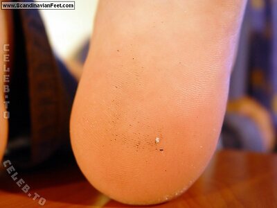 Scandinavian Feet Nude Leaked Photo #2277