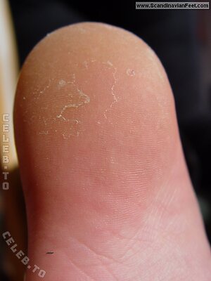 Scandinavian Feet Nude Leaked Photo #3842