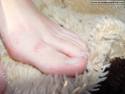 Scandinavian Feet Nude Leaked Photo #3937