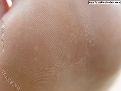 Scandinavian Feet Nude Leaked Photo #4003