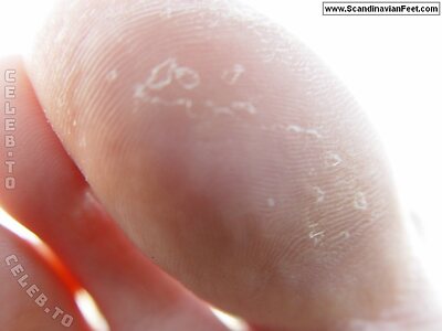 Scandinavian Feet Nude Leaked Photo #4004