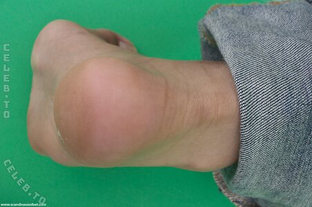 Scandinavian Feet Nude Leaked Photo #4922