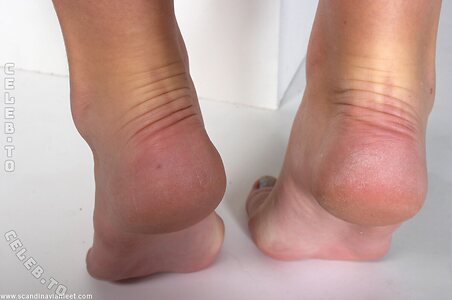 Scandinavian Feet Nude Leaked Photo #5210
