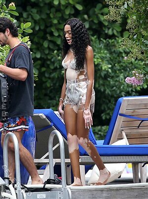 Winnie Harlow Nude Leaked Photo #5