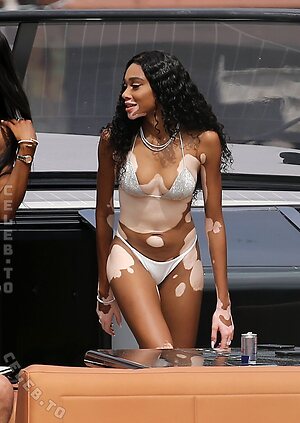 Winnie Harlow Nude Leaked Photo #7