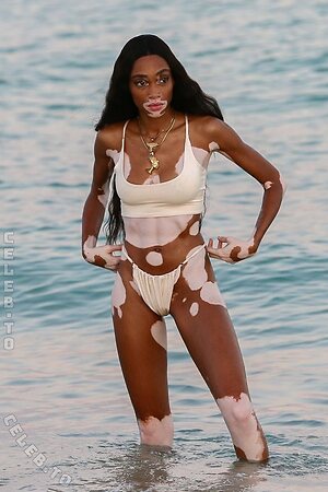 Winnie Harlow Nude Leaked Photo #30