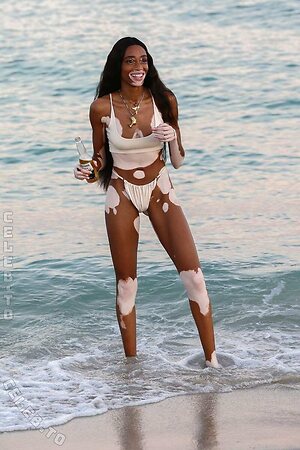 Winnie Harlow Nude Leaked Photo #32