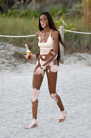 Winnie Harlow Nude Leaked Photo #33