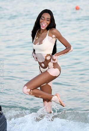 Winnie Harlow Nude Leaked Photo #34