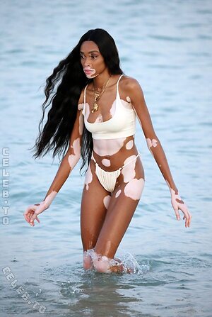 Winnie Harlow Nude Leaked Photo #35