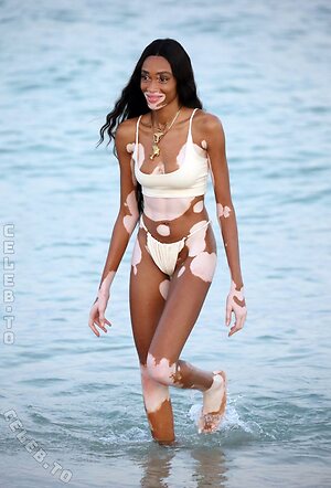 Winnie Harlow Nude Leaked Photo #36