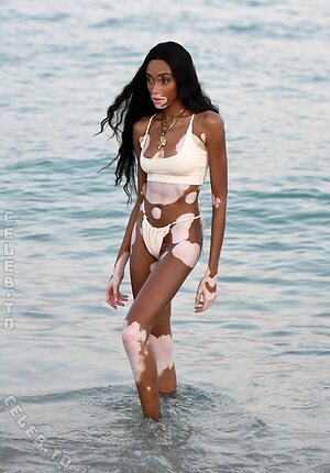Winnie Harlow Nude Leaked Photo #38