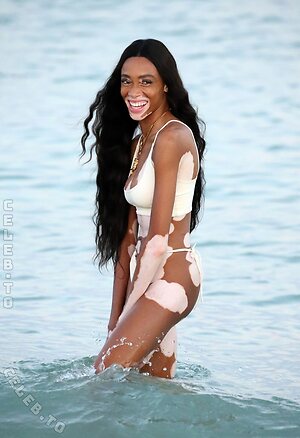 Winnie Harlow Nude Leaked Photo #44