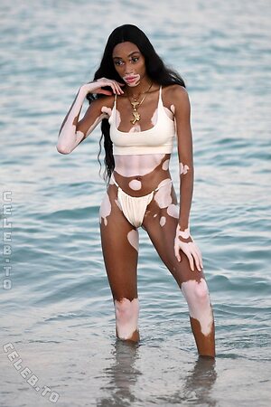 Winnie Harlow Nude Leaked Photo #45