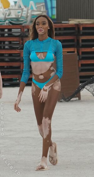 Winnie Harlow Nude Leaked Photo #49