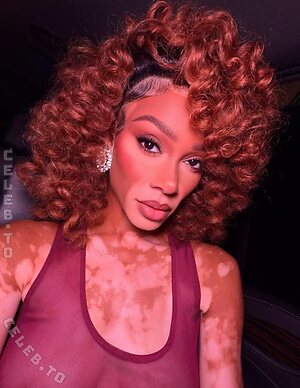 Winnie Harlow Nude Leaked Photo #67