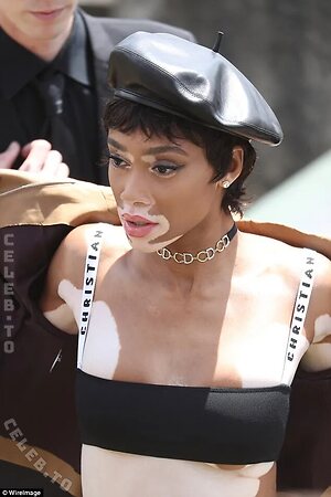 Winnie Harlow