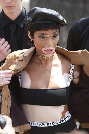 Winnie Harlow photo