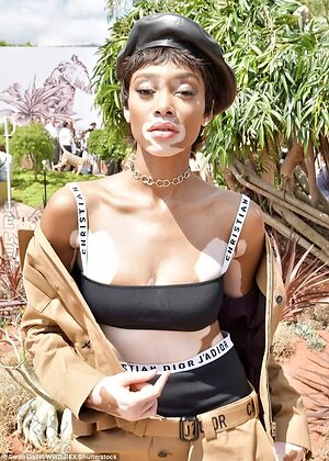 Winnie Harlow photo