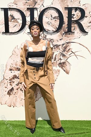 Winnie Harlow photo