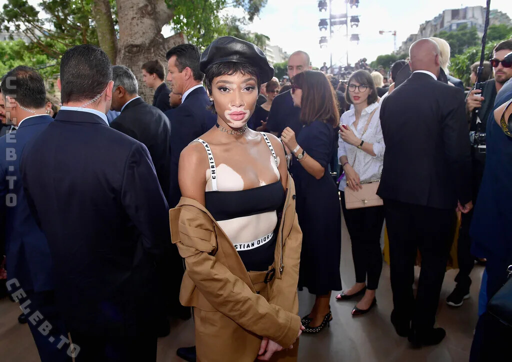 Winnie Harlow photo