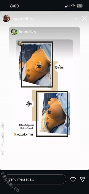 xoxokxmii Nude Leaked Photo #5