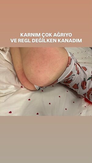Zeynepiksy . Zeynep leaked photo #29